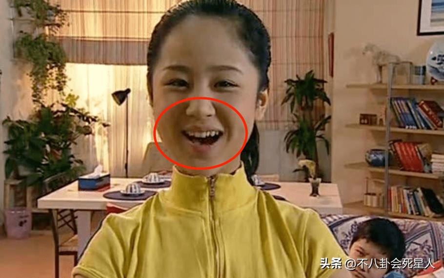 戴牙套是双刃剑：毛不易拯救一口烂牙，刘雯、肖战却变难看了