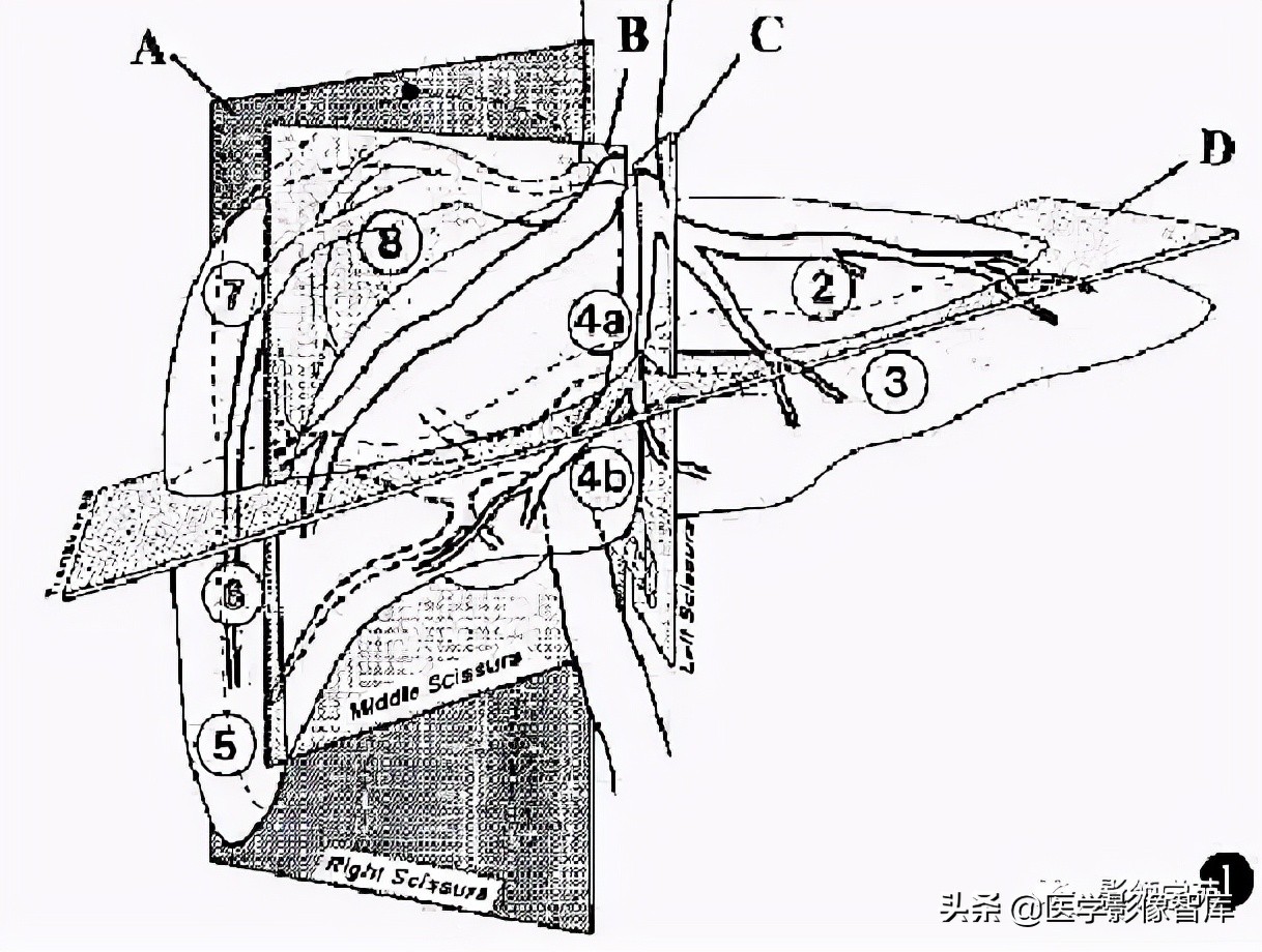肝脏影像分叶分段解剖图,肝脏分段解剖图谱