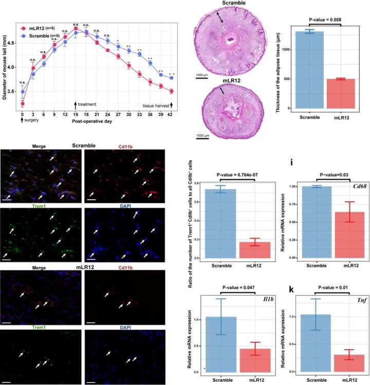 发现|继发性淋巴水肿的潜在治疗靶点及药物