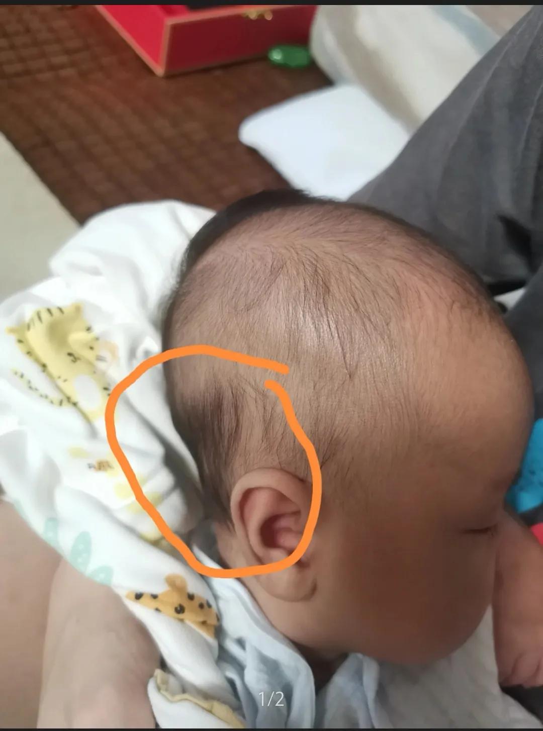 一个月宝宝偏头睡怎么调整,成年人偏头怎么矫正