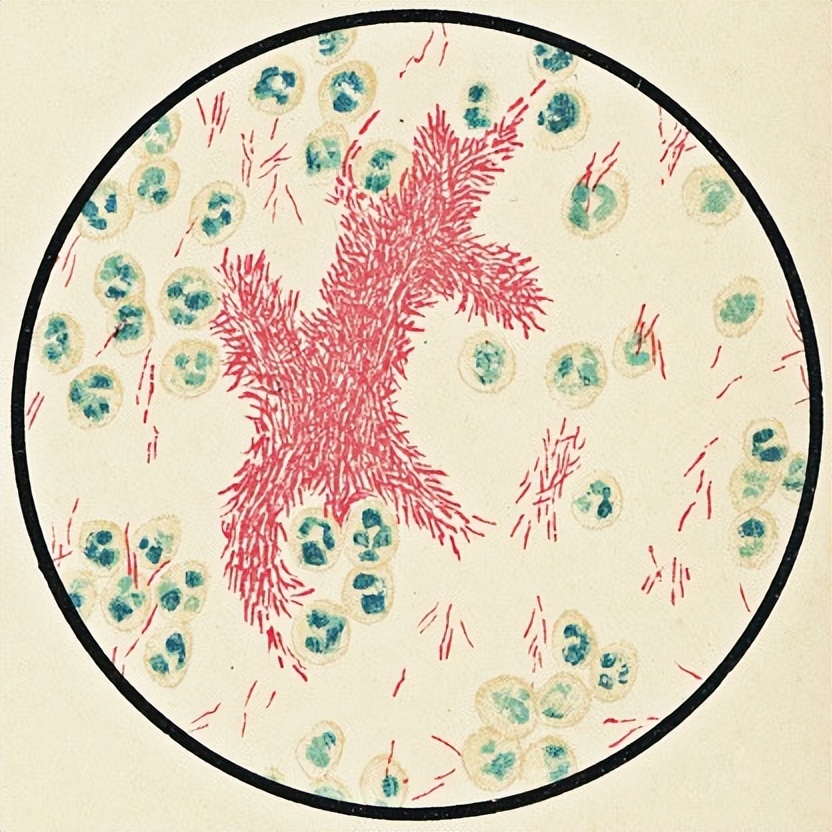 放线菌菌剂的作用包括哪些,放线菌代谢产物的作用