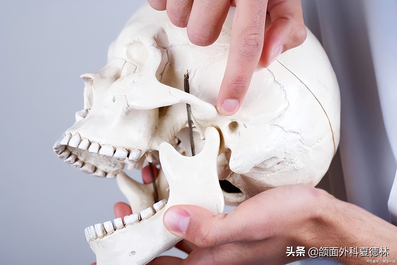 歪下巴正颌手术,颞颌关节紊乱下巴歪复位