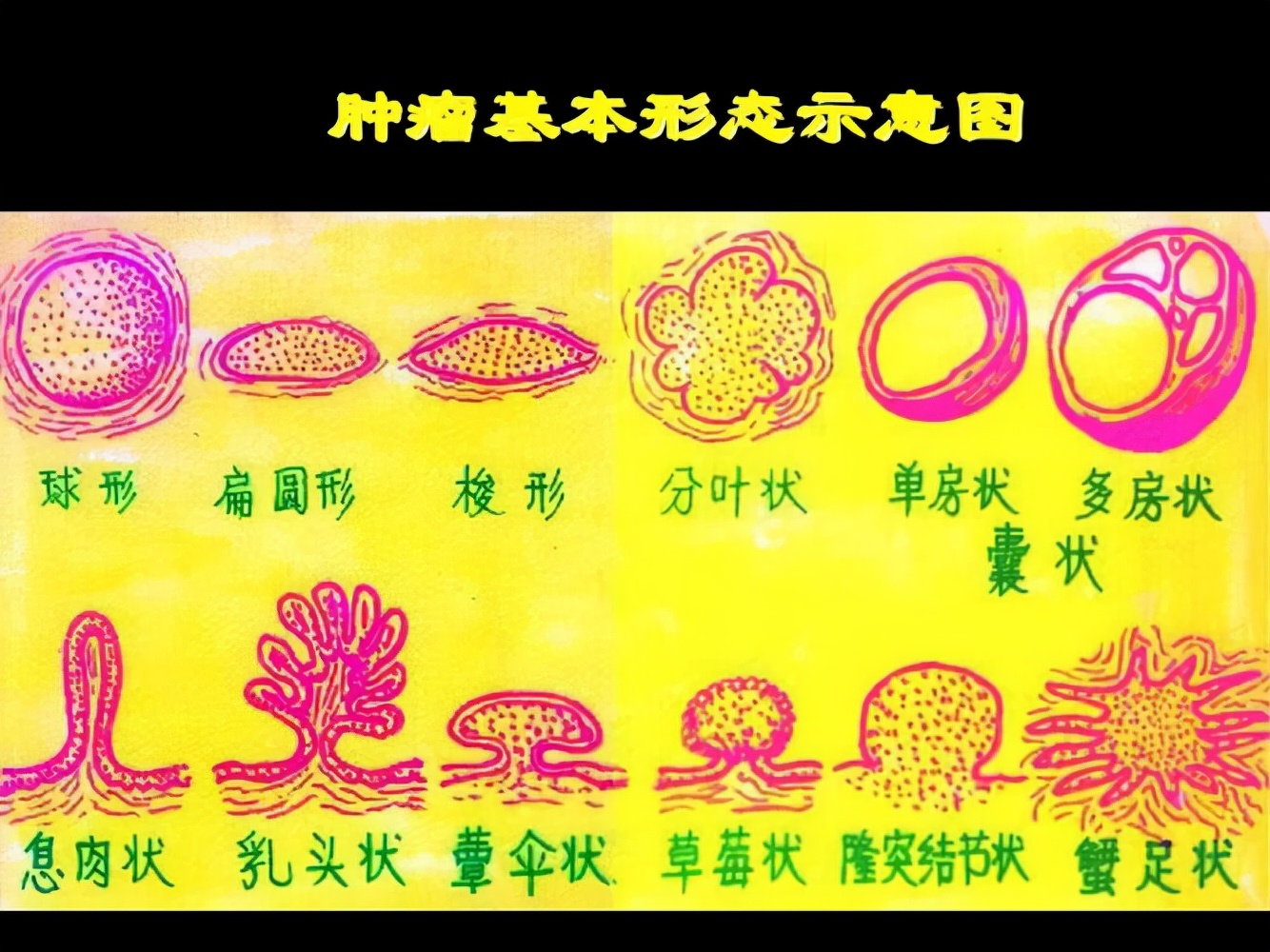 8岁男孩查出肾衰竭,肾衰竭患者亲身经历