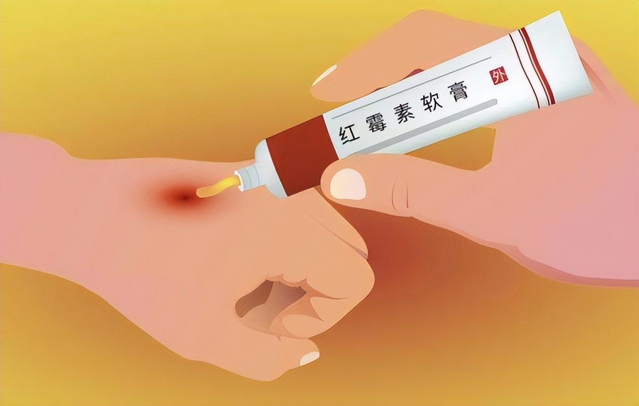 药店不会告诉你的便宜有效的药,药店的八种药简单又好用