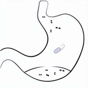 雌二醇用量用法,雌二醇激素用法