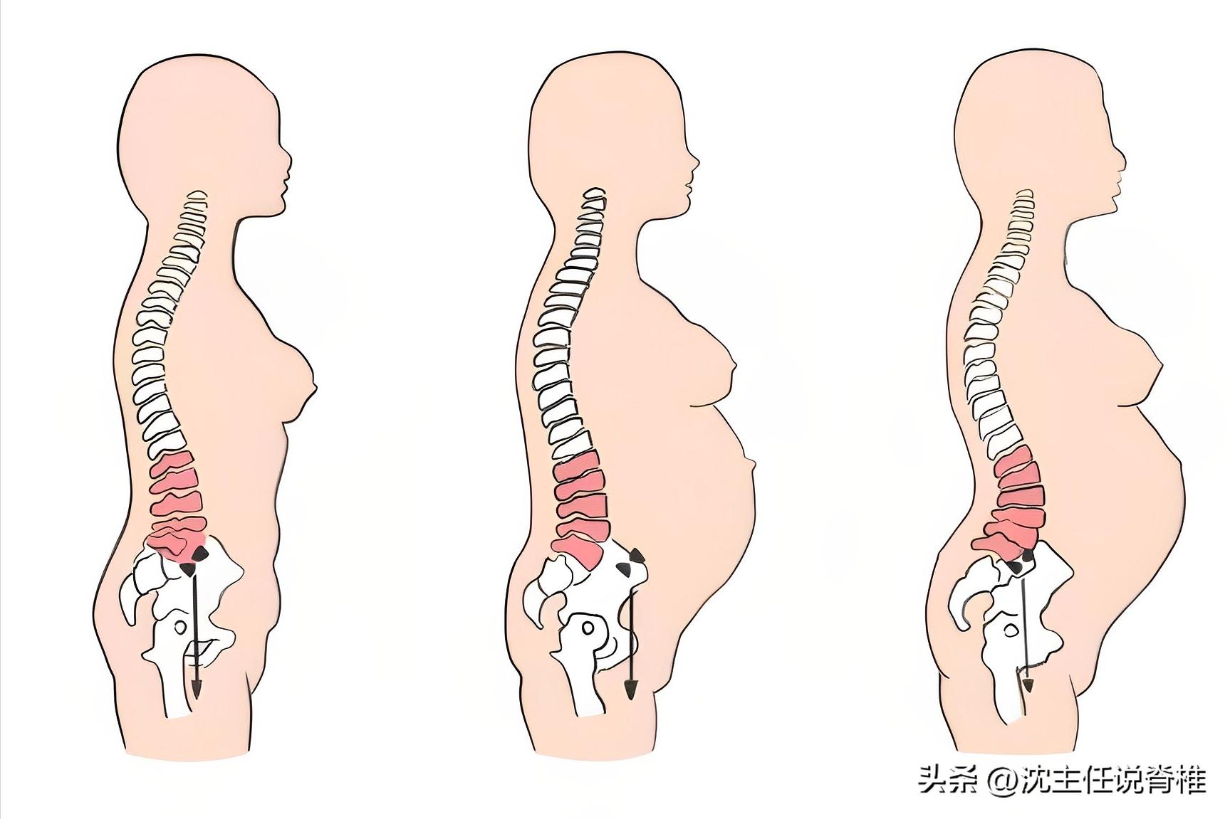 女性产后骶骨疼是什么原因,产后盆底酸疼痛怎么治疗