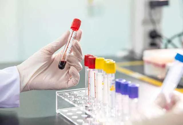 空腹血糖7-8之间而餐后血糖不高,孕期空腹血糖高但是餐后血糖正常