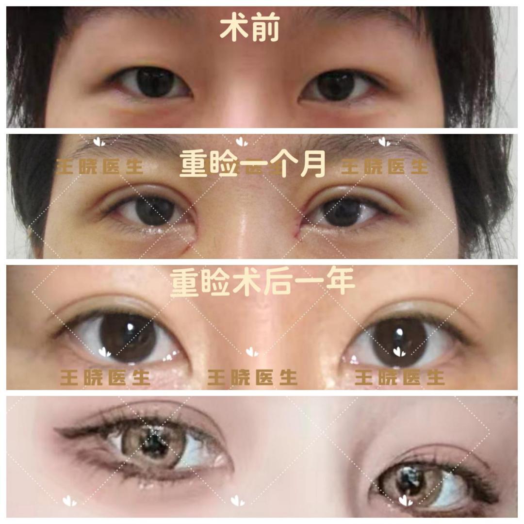 医疗美容变美秘诀,美容科医生教你悄悄变美