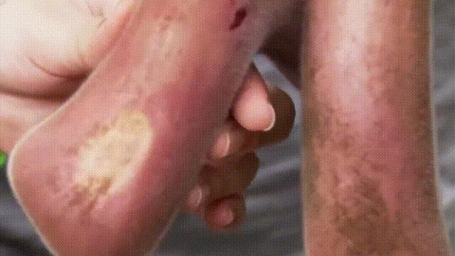 超级血液代表着什么,超级血液是啥