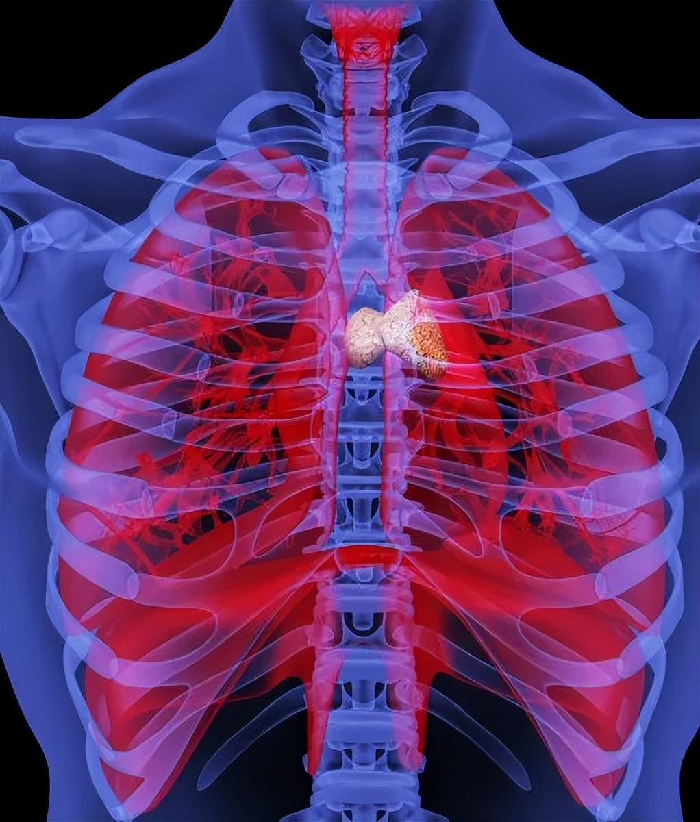 眼皮抬不起来吃什么药,眼皮抬不起来啥病