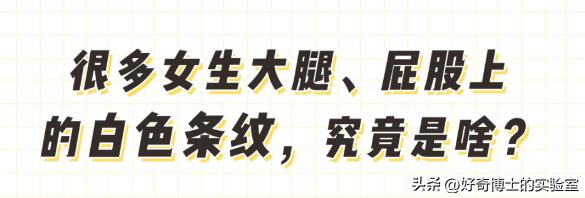 大腿上有白色条纹怎么回事,女生大腿外侧有红条纹是什么原因