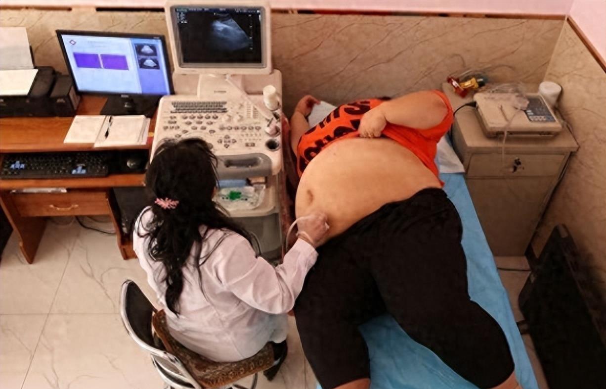 校花惨遭肥胖困扰,丈夫无情虐待,下场令人心酸唏嘘