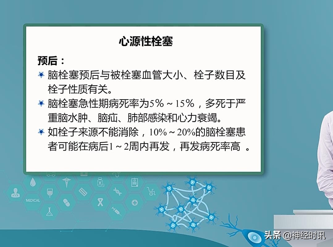 神经病学-脑血管疾病-心源性脑栓塞课件分享加视频讲解