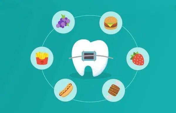 正畸治疗须知,正畸有哪些注意事项