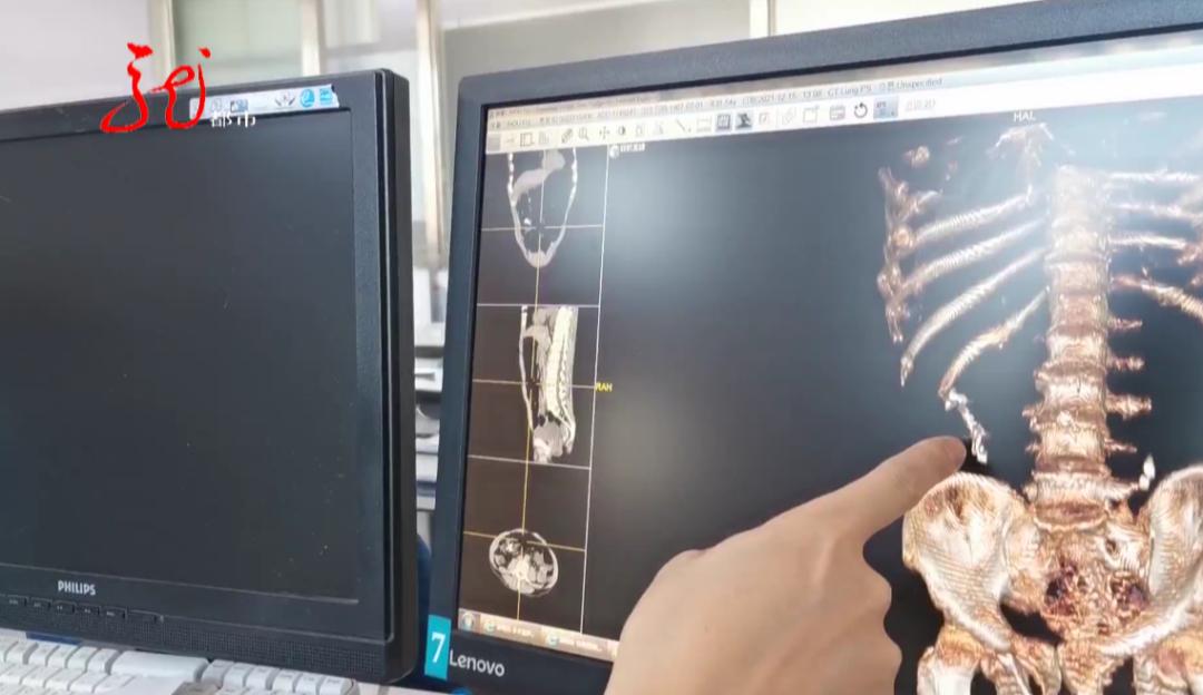 大庆一女子肚疼求医，居然看到“五个爪”！医生提醒：一定要小心