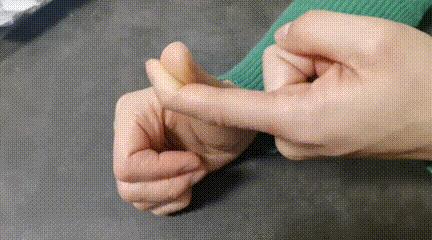 中年妇女手指腱鞘炎是怎么回事,更年期脚拇指腱鞘炎