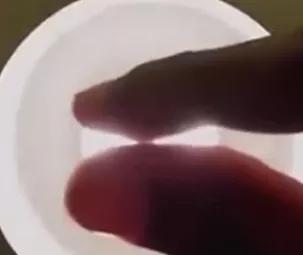 天冷了尿频量少,天冷了尿量多是怎么回事