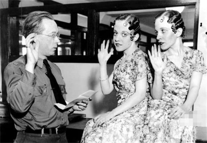 连体人一人去世了另一人会死吗,连体人死亡对另一半有影响吗