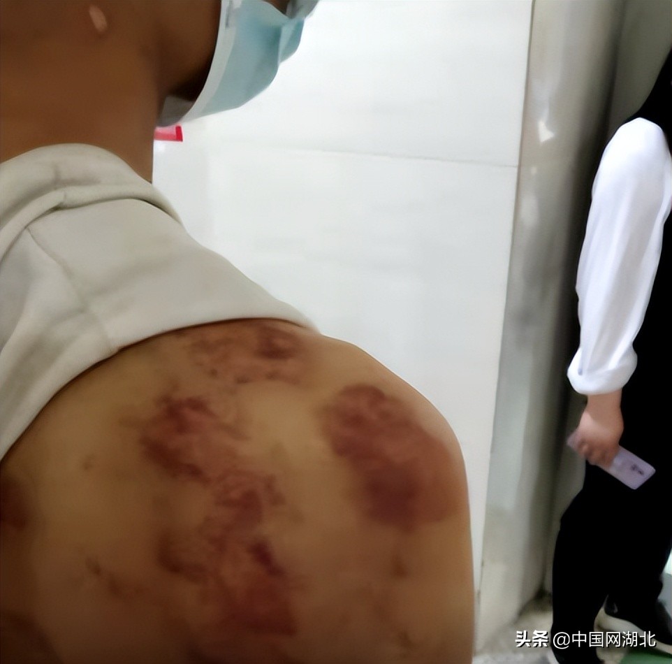 校园霸凌抽皮带,学生被霸凌三年校方回应