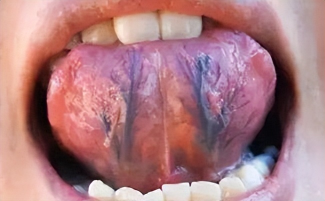 “一白遮百丑,长斑毁所有”?分享一方六味药,补血、活血、祛斑