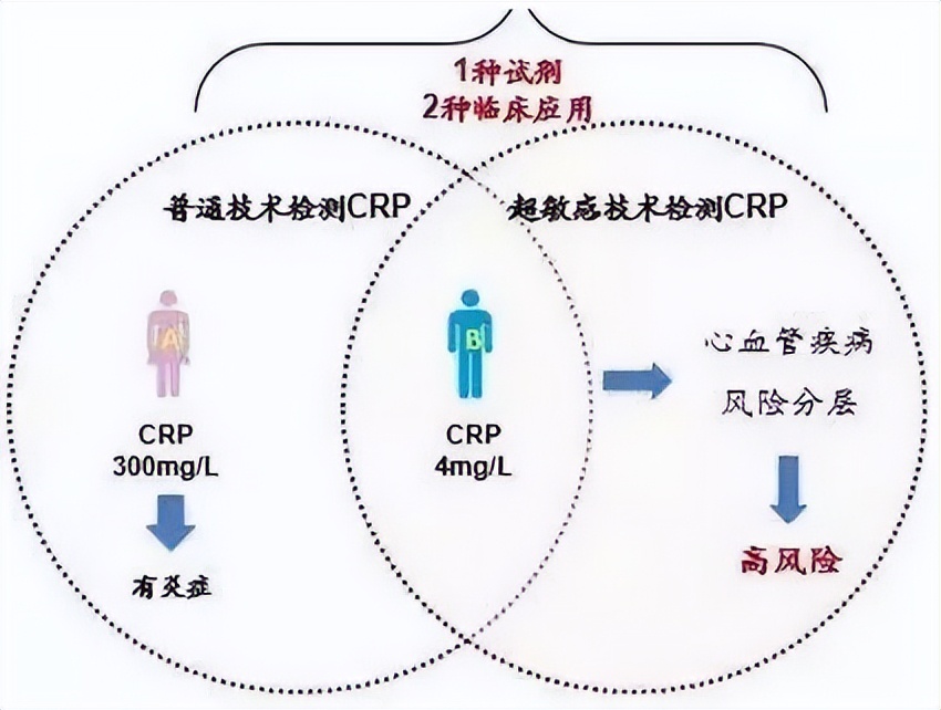 心脏超敏c反应蛋白高说明什么,高血压患者超敏c反应蛋白高怎么办