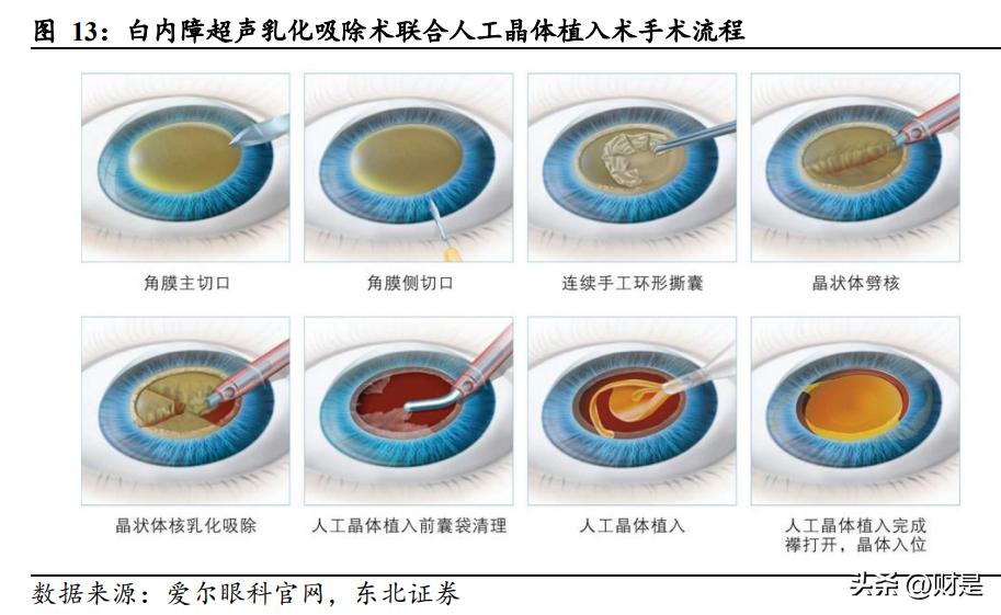 爱博医疗核心产品前景,爱博医疗最新报告
