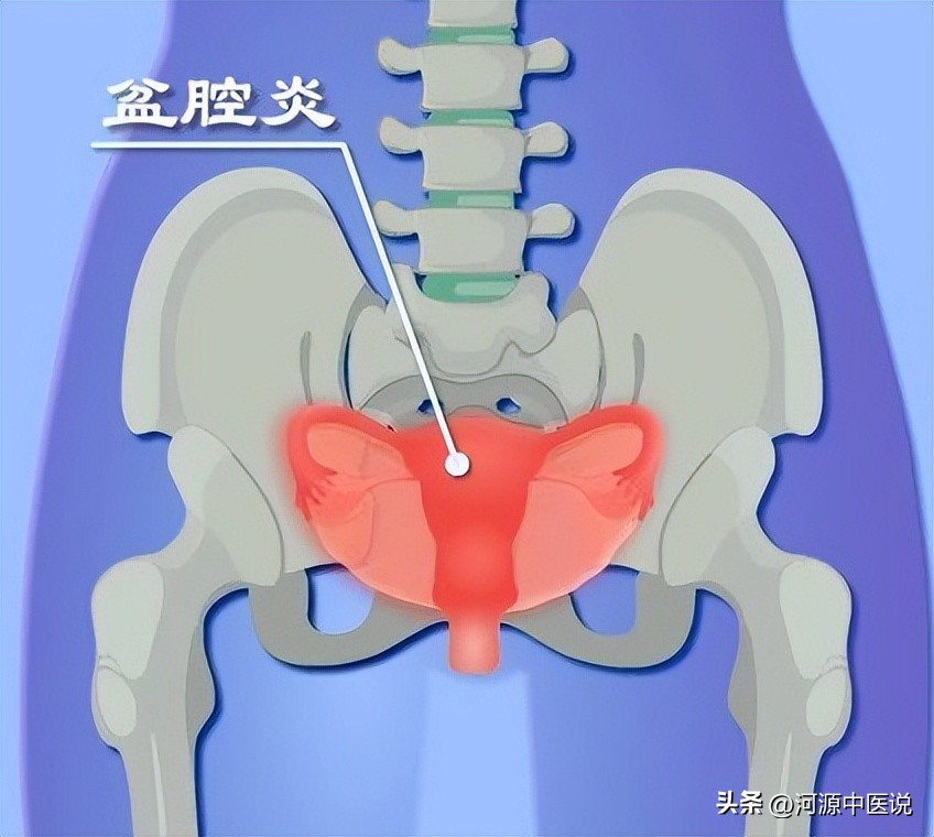白带异常多是宫颈癌吗,白带异常会引起哪些疾病