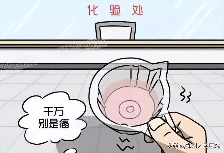 体检查出尿潜血+++,可没看见尿液里有血啊,啥情况?