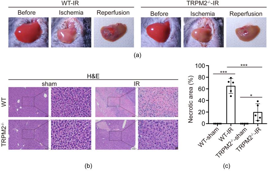 research最新研究进展,大鼠肝缺血再灌注损伤