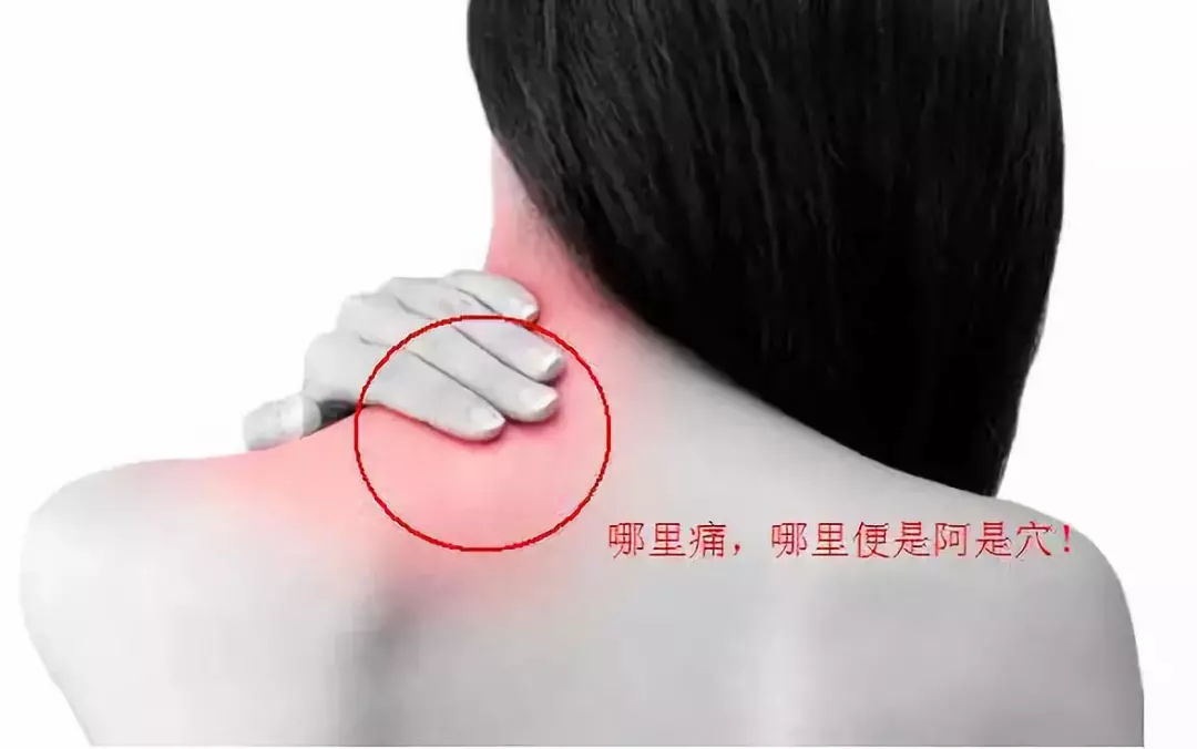 中医针灸治疗颈椎病原理,颈椎病针刀按摩针灸哪种方法好