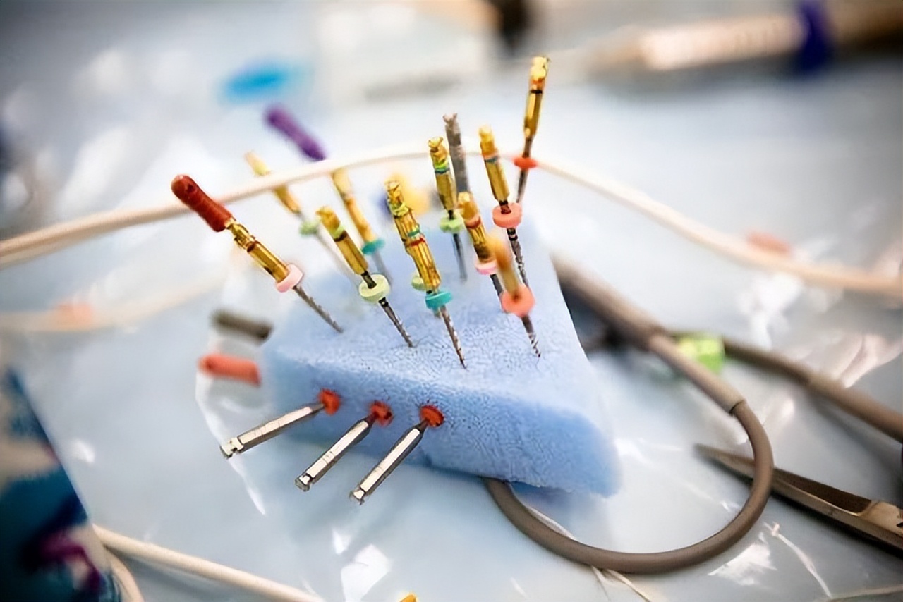 根管治疗断针原因和处理方法,根管治疗断针原因及处理