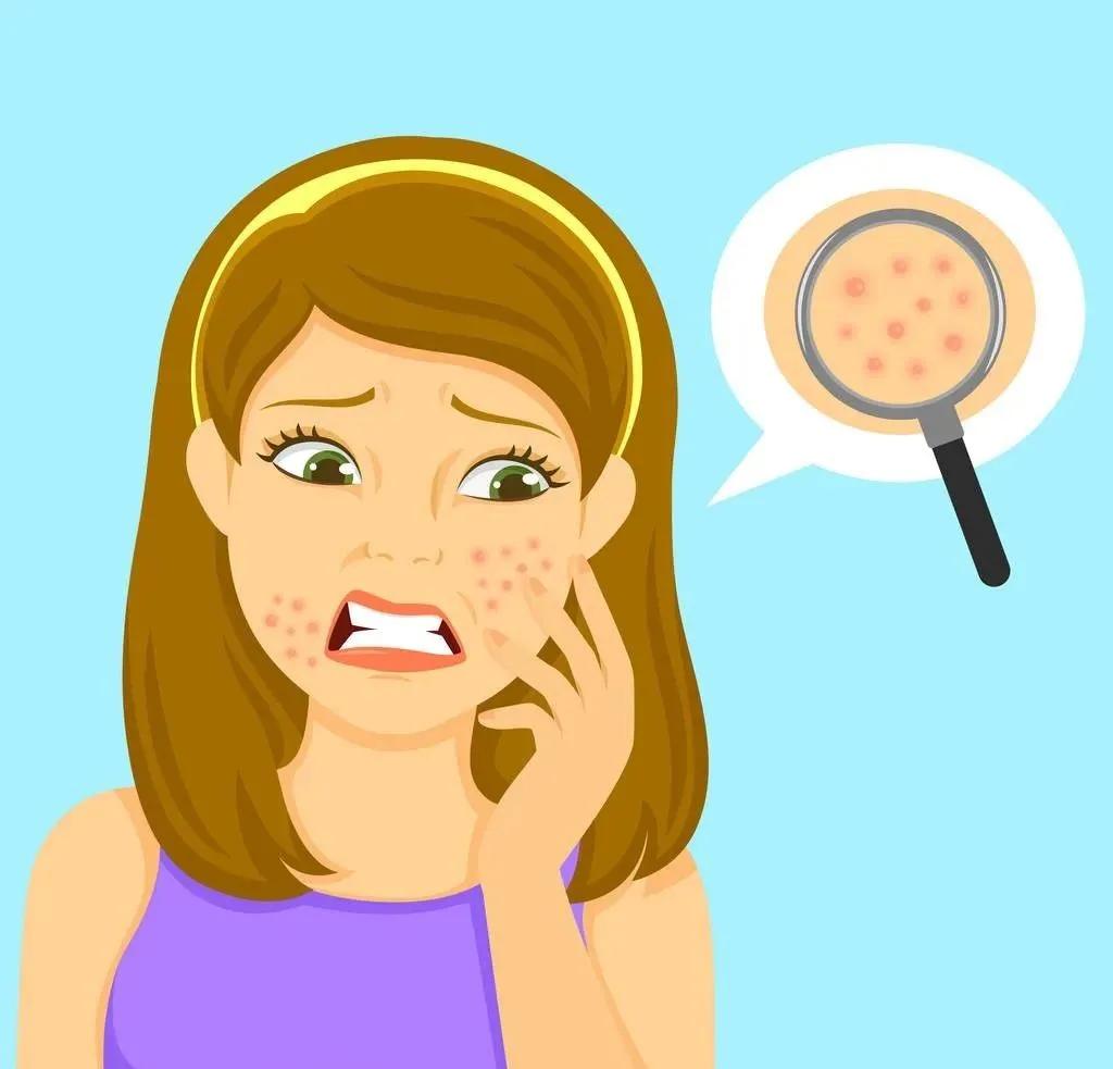 脸上长痘斑和疮怎么治,脸上长疮长青春痘如何治疗
