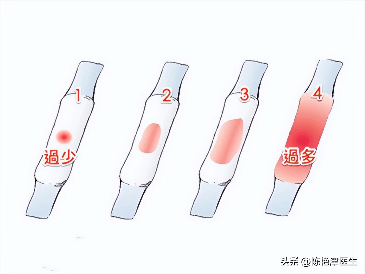 女性为什么容易长子宫肌瘤?提醒:平时尽量避免3个行为,别忽视