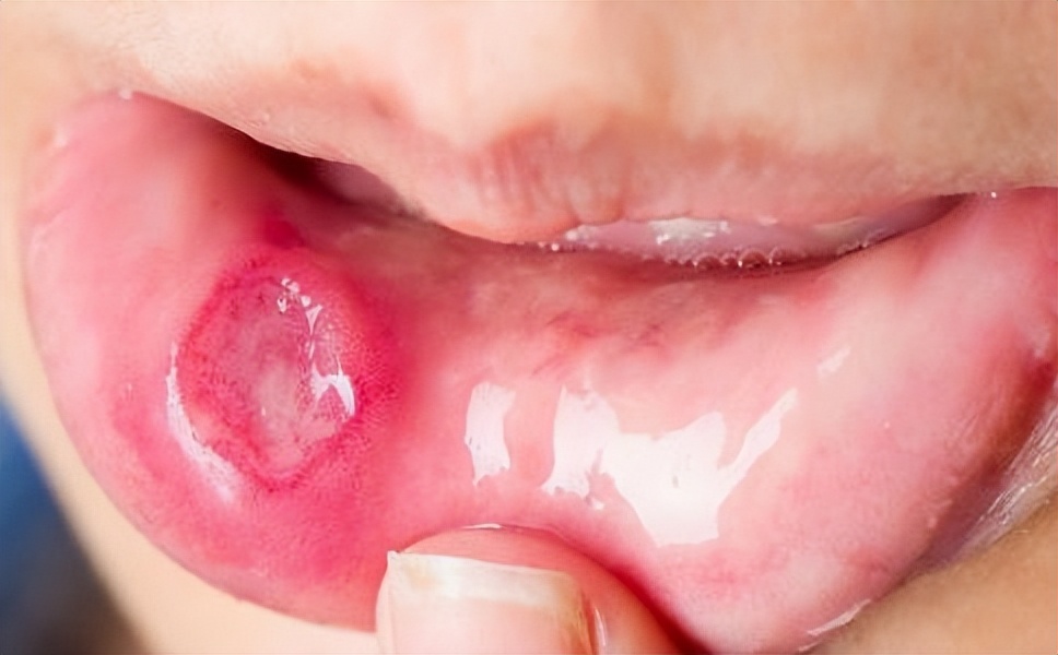 连花清瘟胶囊是非处方药,连花清瘟胶囊