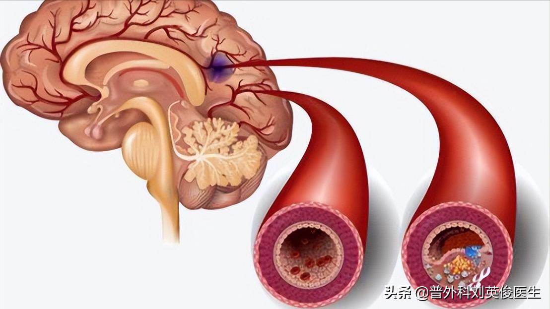 如何科学有效地戒酒或限制饮酒,长期喝酒怎么戒酒最有效