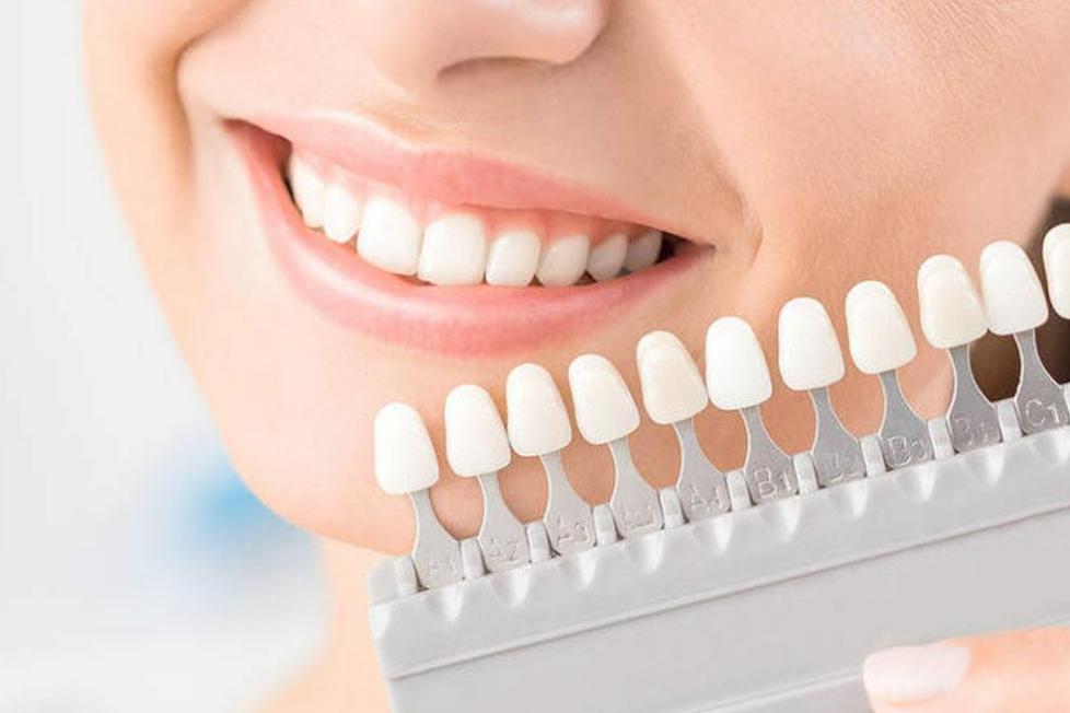 烤瓷牙好不舒服,烤瓷牙好不好看