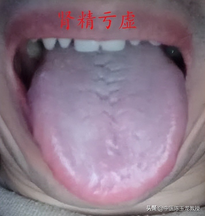 肾虚脚冷腰酸尿频,尿频腰酸是肾阳虚表现吗