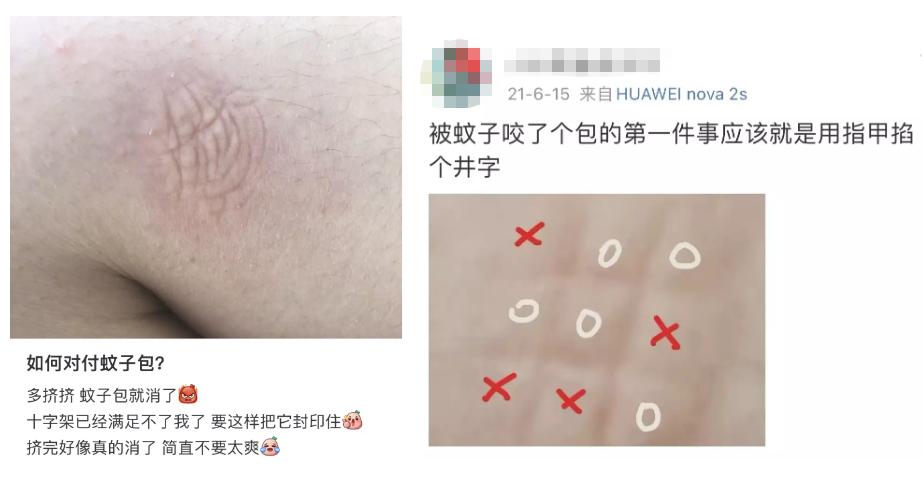 被蚊子咬掐十字止痒法,被蚊子叮咬后掐十字有用吗
