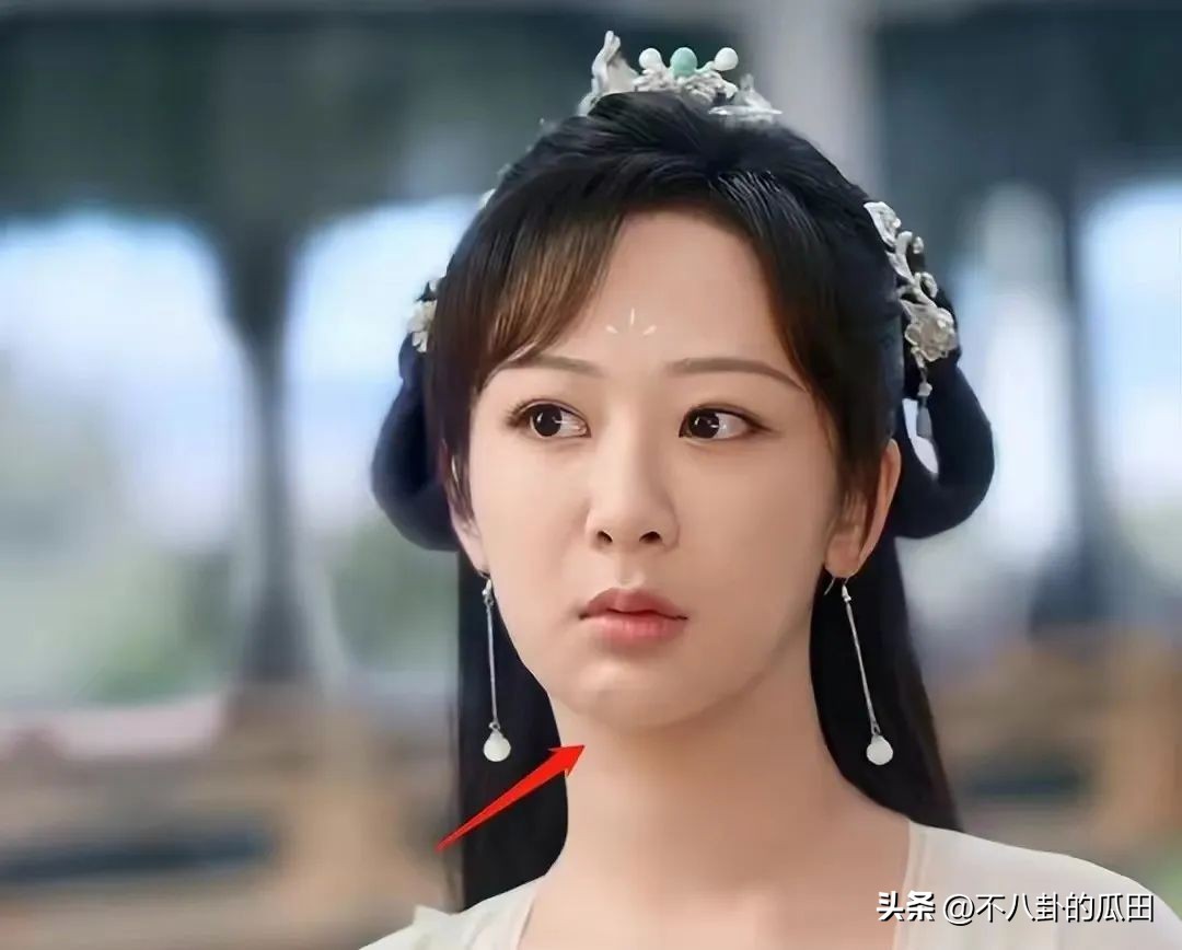 蔡徐坤下巴太尖惹争议图片,蔡徐坤下巴是假体吗