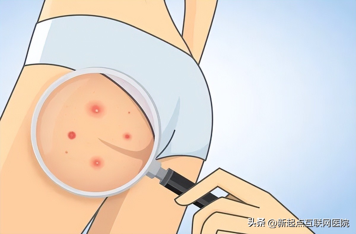 别人坐热的凳子会传染妇科病吗,坐凳子能传染皮肤病吗