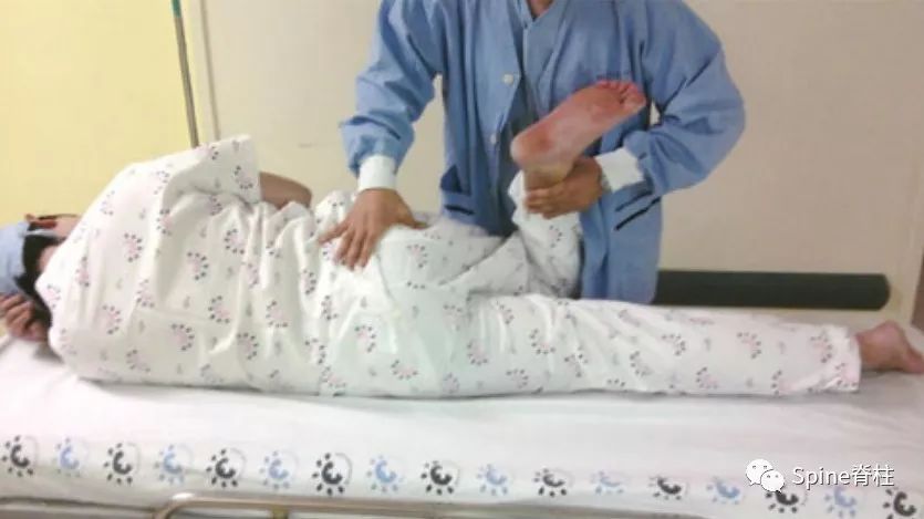 腰椎间盘突出下肢放射痛严重吗,下肢放射疼痛是间断性严重吗