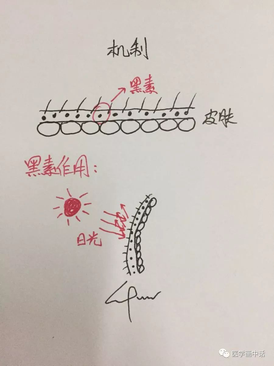 面部*褐斑黄**的诊断及治疗简析