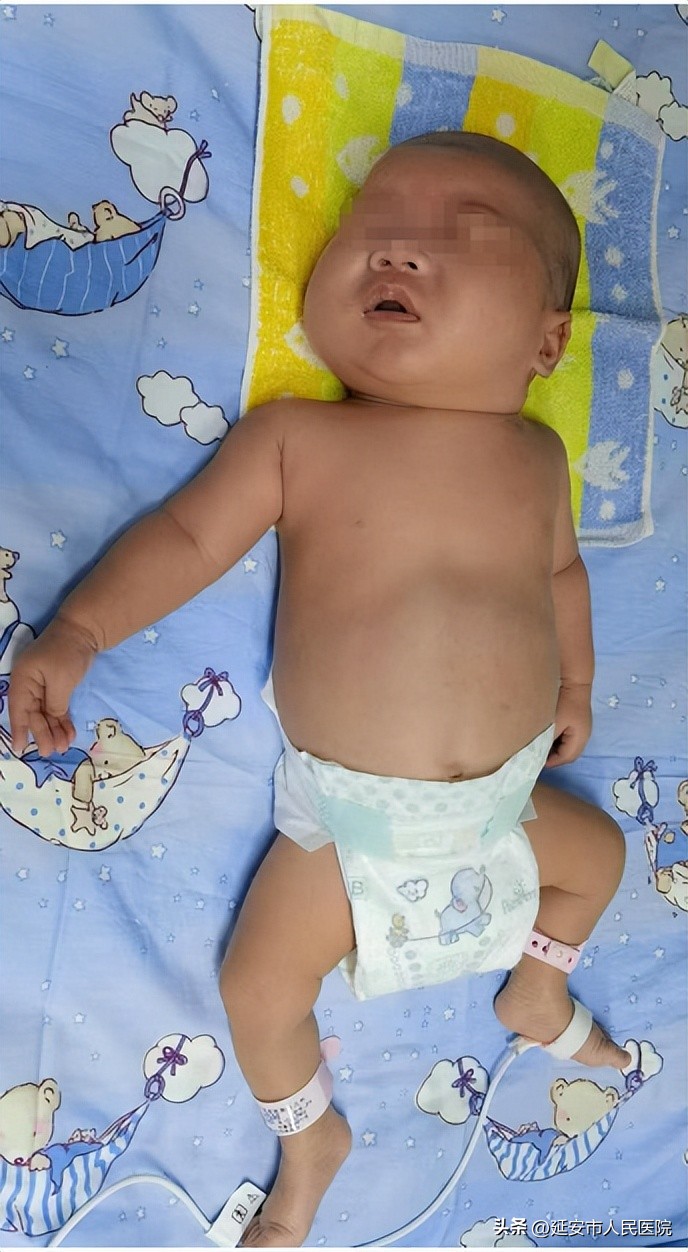 产妇宫腔感染早产宝宝命悬一线，多学科联合救治成功脱险