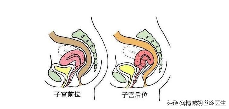 子宫后位怎么样容易受孕,子宫前置跟子宫后置的区别