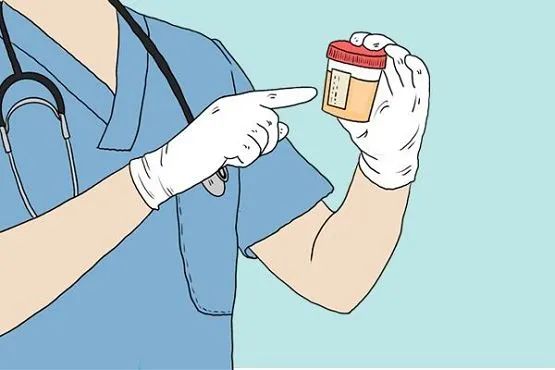 为什么一体检一住院,护士小姐姐就催你留尿尿?