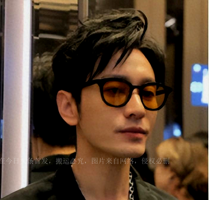 秃头潘玮柏,明星是怎么解决脱发的