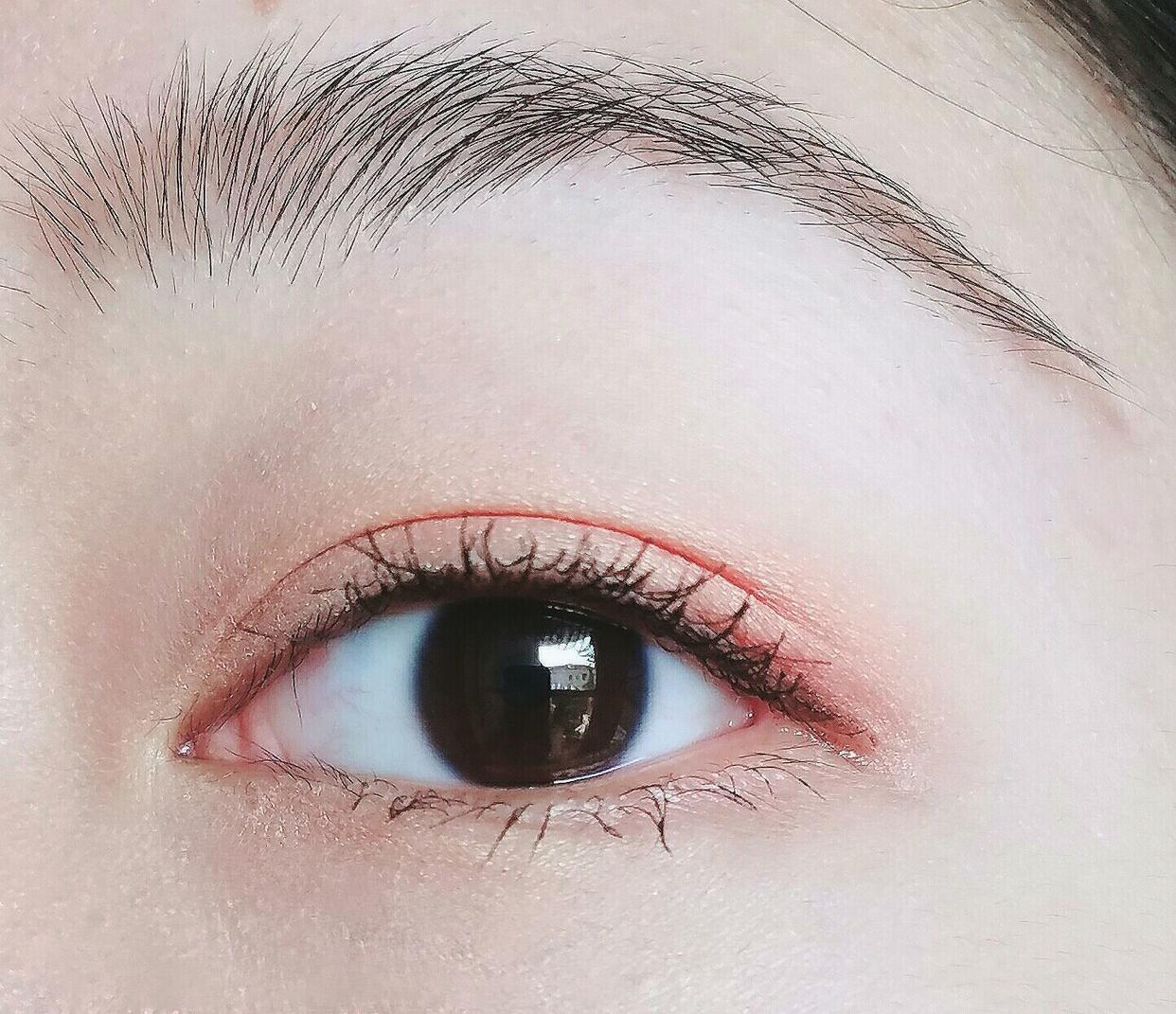 最近哪个明星割双眼皮前后对比,明星一般都做什么样的双眼皮