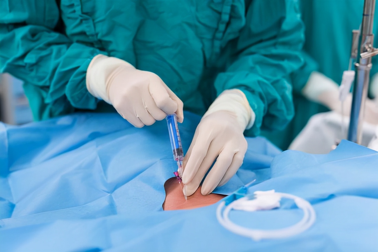 “蛋疼”折磨了他三个月之后,终于进行了治疗