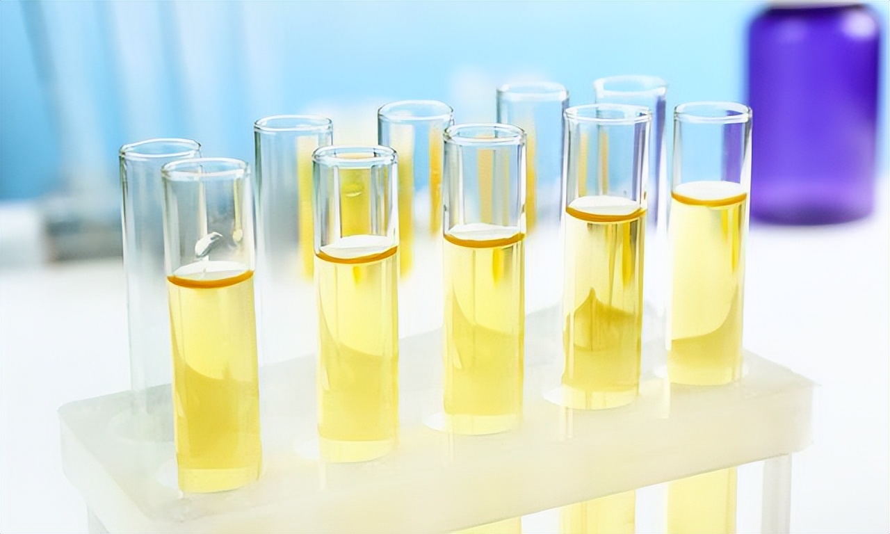 上午尿液颜色深下午尿液颜色无色,尿液颜色像菊花茶的颜色