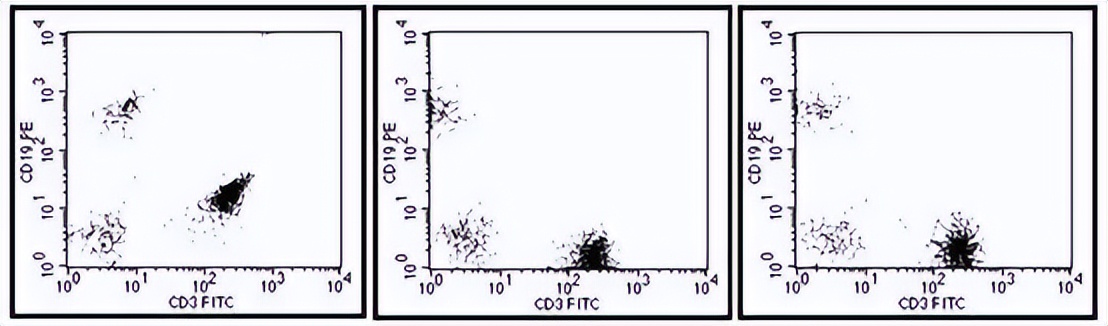 流式细胞术的主要内容,流式细胞术浆细胞多少正常